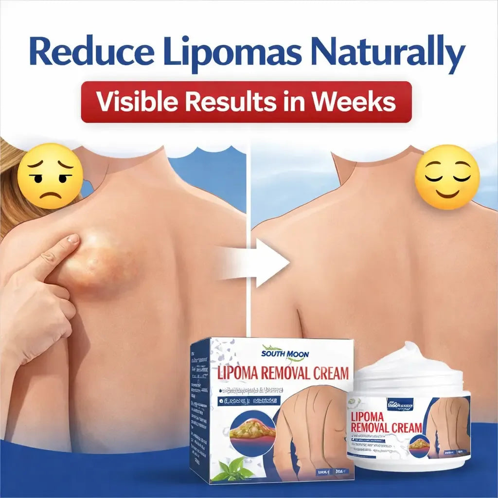 Lipoma Removal Cream